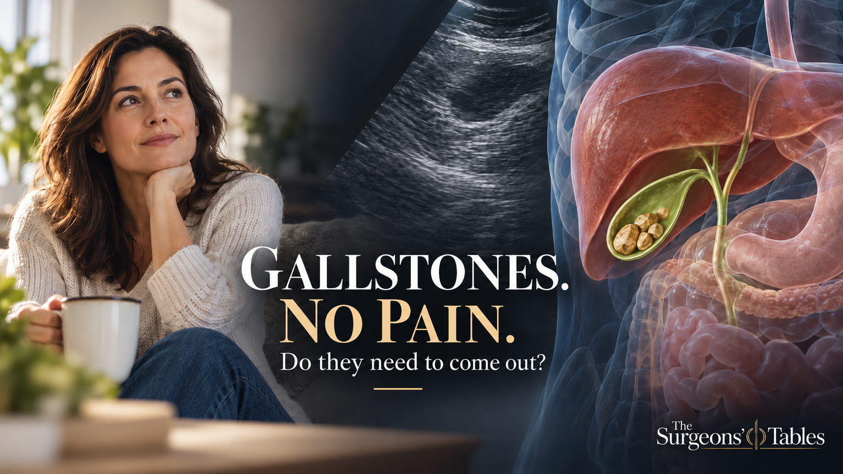 Gallstones but No Pain: Do You Really Need Surgery Before Something Goes Wrong?