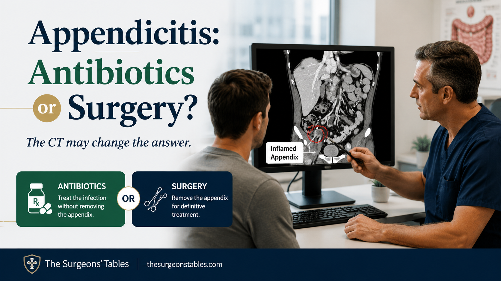 Appendicitis: Antibiotics or Surgery? The CT Finding That Can Change the Decision