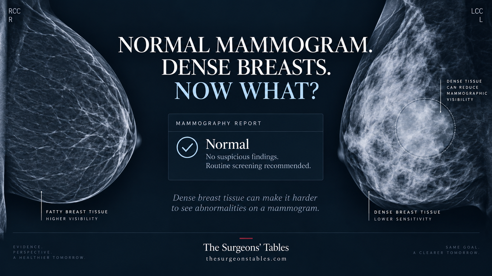Your Mammogram Is Normal – But Your Breasts Are Dense. Is Another Scan Worth the False Alarms?