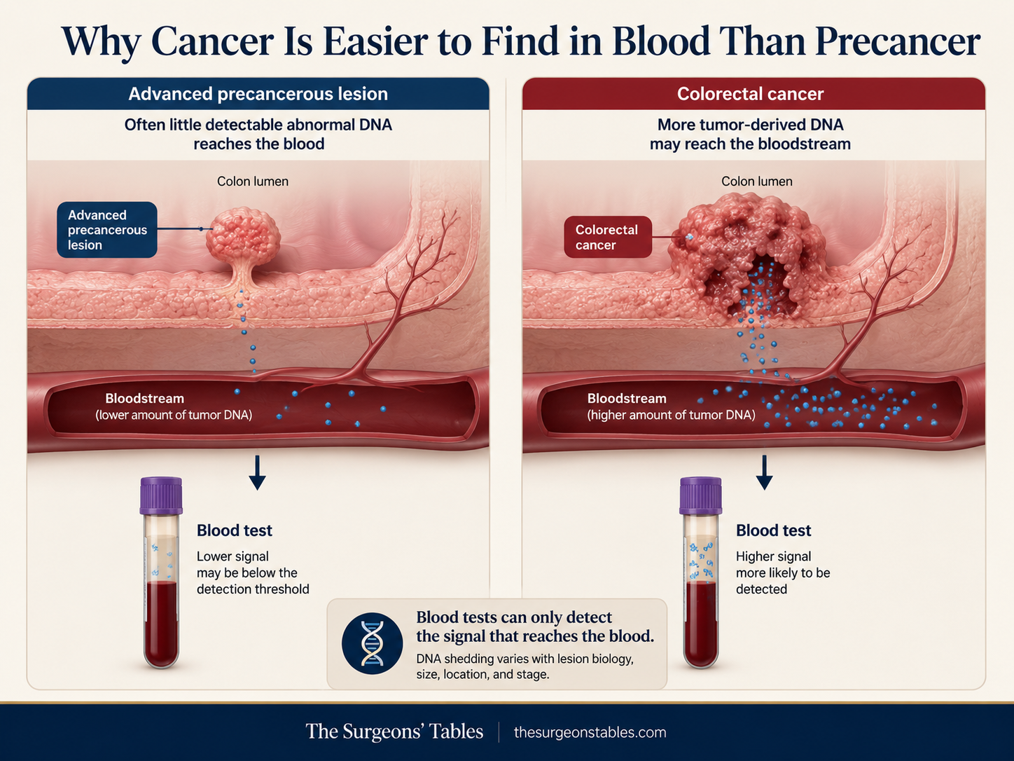 Diagram comparing limited detectable cell-free DNA release from an advanced precancerous colorectal lesion with greater tumor-derived DNA release from established colorectal cancer.