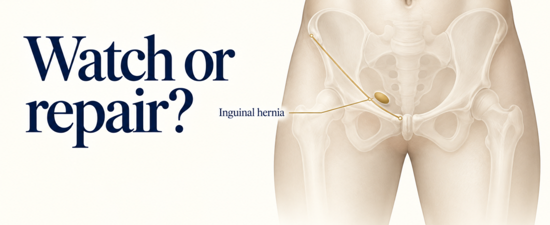 Inguinal Hernia: Do You Need Surgery Now—or Can It Wait?