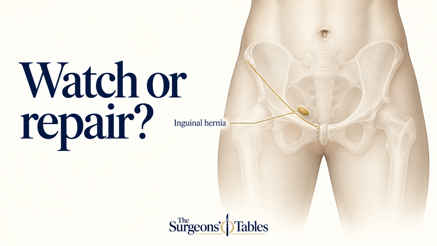 Inguinal Hernia: Do You Need Surgery Now—or Can It Wait?