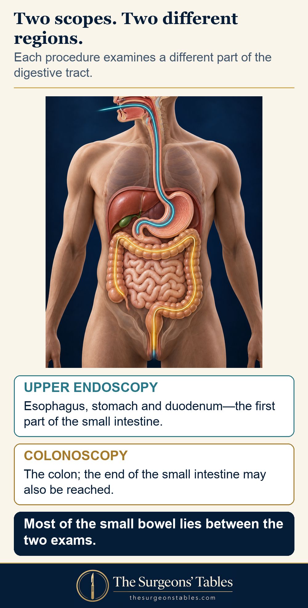 Upper endoscopy examines the esophagus, stomach and duodenum; colonoscopy examines the colon and may reach the terminal ileum.