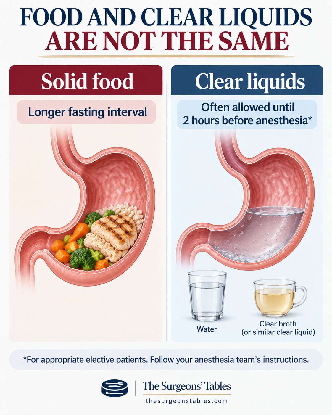 Comparison showing that solid food requires a longer preoperative fasting interval while clear liquids may be permitted closer to anesthesia in appropriate elective patients.